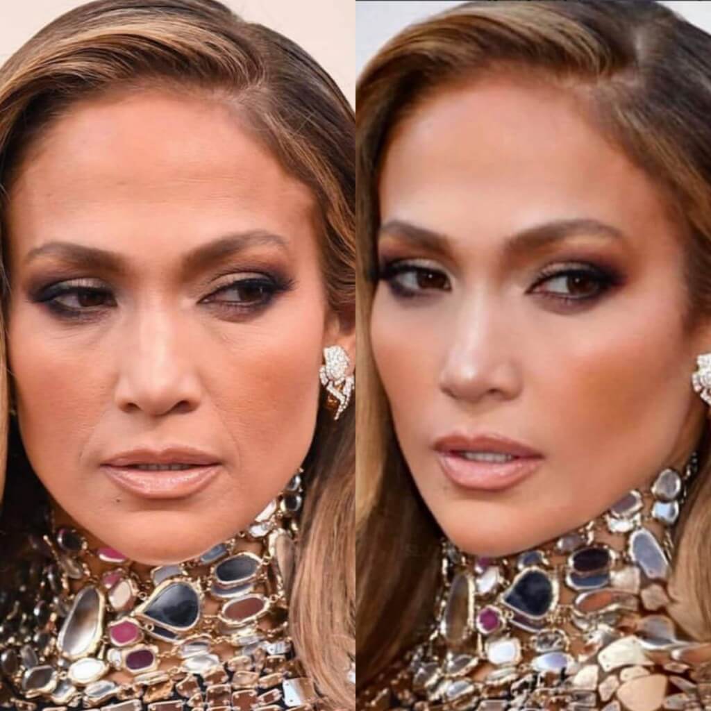 JLO before and after